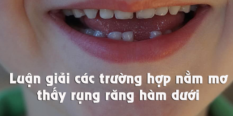 Giải mã chi tiết những bối cảnh nằm mơ thấy rụng răng hàm dưới