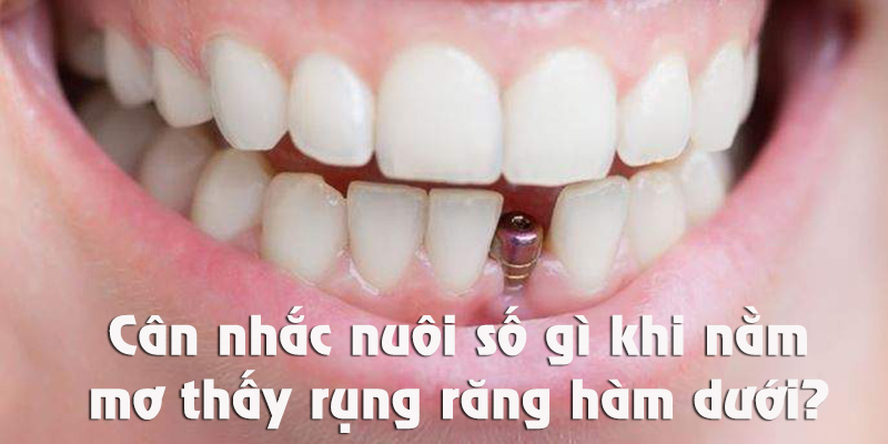 Nằm mơ thấy rụng răng hàm dưới thì nuôi số gì thì thắng lớn?